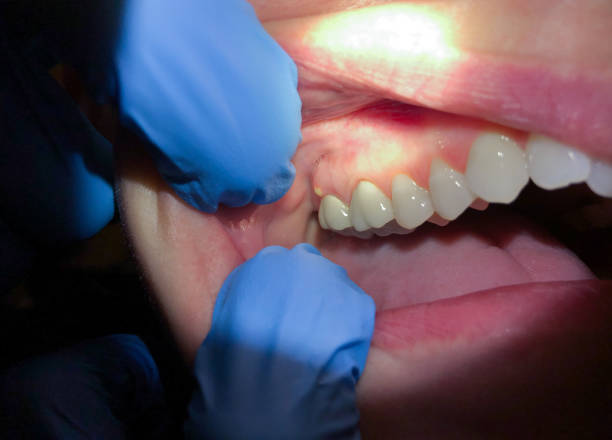 Best Emergency Gum Pain Relief  in Gages Lake, IL